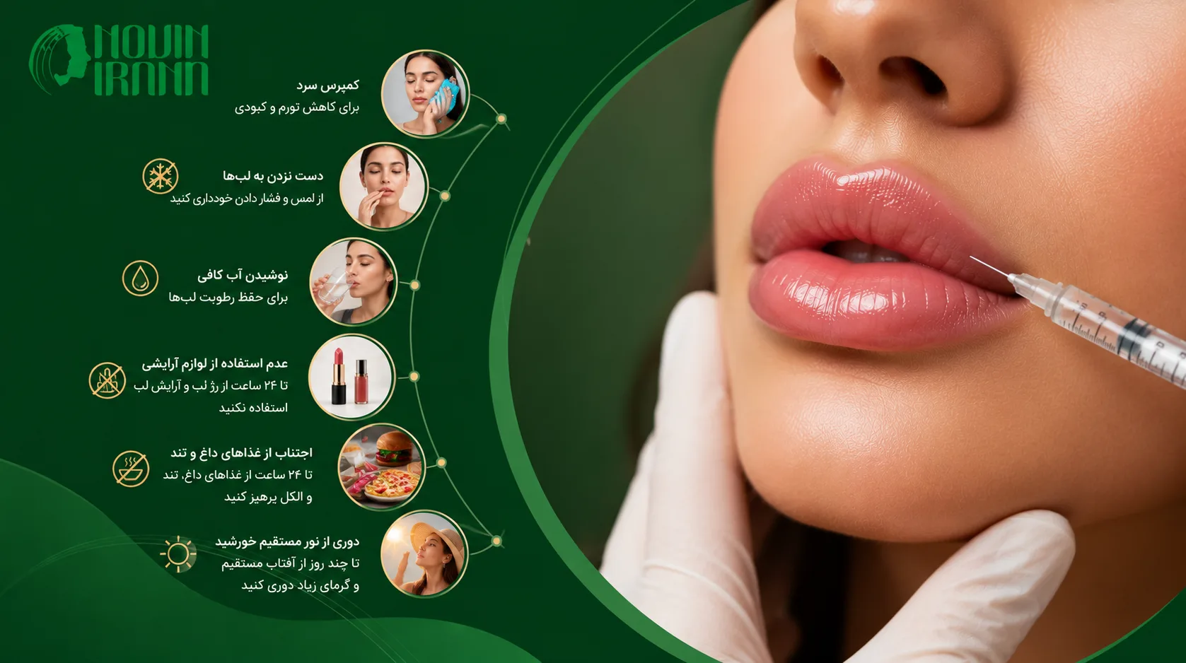 مراقبت های بعد از تزریق ژل لب چاکدار